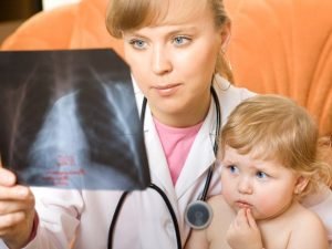 Read more about the article Pneumonia pada Anak Ternyata Juga Bisa Diatasi dengan Minyak Kelapa