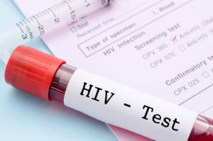 Read more about the article Apakah Test HIV/AIDS Sekarang Ini Akurat?