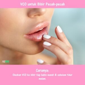 Read more about the article Tips Pemakaian Minyak Kelapa Murni untuk Bibir Kering & Pecah-pecah