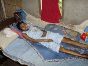 Read more about the article Proyek HIFON 01 – Pasien Lupus, Ketut Suarningsih, Bali